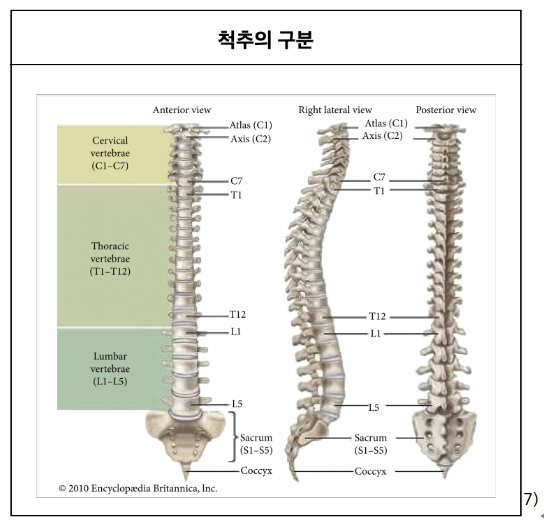 특발성 측만증의 변형위치에 따른 분류